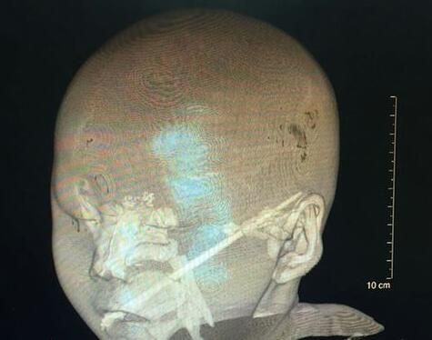 ���Ӳ���2�q�������X