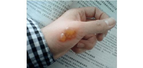 �C����Ҫ����Ó������ ����ׂ�(g��)С���R(sh��)